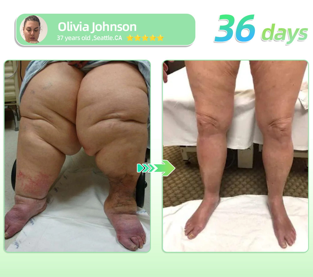 ๐ถ๐๐๐๐๐๐๐ ๐บ๐๐๐๐๐จ๐ฆ|๐๐๐๐๐๐ผ๐ยฎ๐บ๐ฟ๐-๐  ๐บ๐ฐ๐ฟ-๐ฐ๐ต-๐ถ๐ต๐ฌ ๐ฏ๐๐๐๐๐ ๐บ๐๐๐๐๐๐๐ ๐ถ๐๐๐ ๐ณ๐๐๐๐๐
๐ธ (๐๐ฎ๐ฌ๐ญ ๐จ๐ง๐๐ ๐ ๐๐๐ฒ, ๐ฏ๐ข๐ฌ๐ข๐๐ฅ๐ ๐๐ก๐๐ง๐ ๐๐ฌ ๐ข๐ง ๐ ๐๐๐ฒ๐ฌ๏ผ ๐
๐จ๐ซ ๐จ๐๐๐ฌ๐ข๐ญ๐ฒ, ๐๐๐ซ๐๐ข๐จ๐ฏ๐๐ฌ๐๐ฎ๐ฅ๐๐ซ ๐ก๐๐๐ฅ๐ญ๐ก, ๐๐ข๐๐๐๐ญ๐๐ฌ, ๐ฌ๐ฅ๐๐๐ฉ ๐๐ฉ๐ง๐๐, ๐๐ฎ๐ญ ๐๐๐๐ฅ๐ญ๐ก, ๐ฃ๐จ๐ข๐ง๐ญ ๐ข๐ฌ๐ฌ๐ฎ๐๐ฌ, ๐๐ง๐ ๐ฆ๐จ๐ซ๐๐ธ